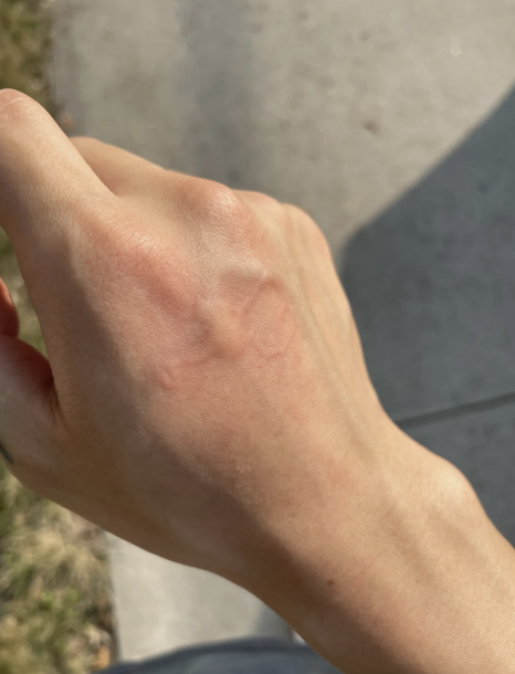 Close-up of a person's hand in natural light with faint veins visible. Background includes concrete and grass. No text or additional objects