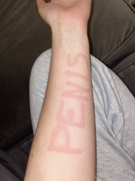 A person's forearm has the word "PENIS" prominently written on it. The background shows a grey couch and grey clothing