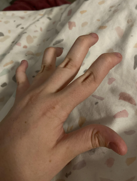 A close-up of a hand showing curved fingers resting on a patterned fabric background