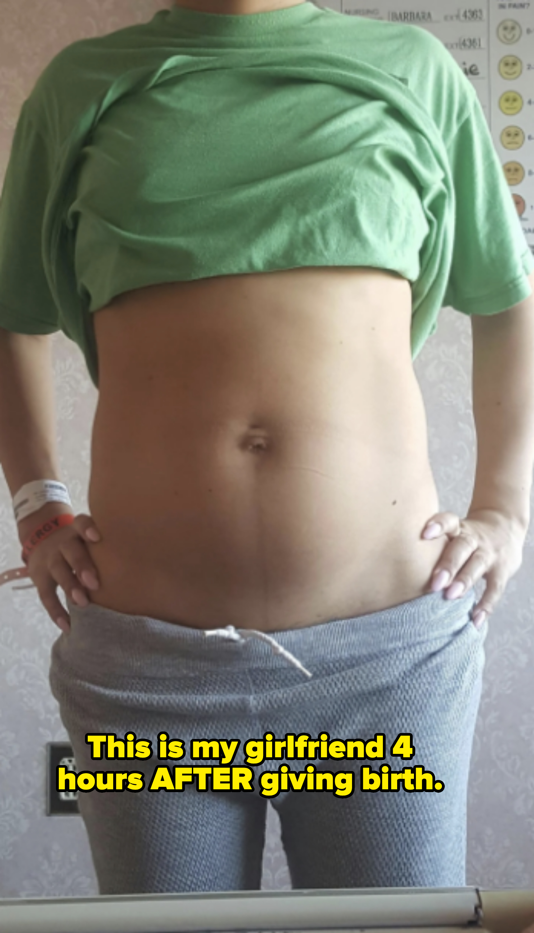 A person with a hospital wristband is lifting their shirt, exposing their midsection, and lower pants to reveal their stomach