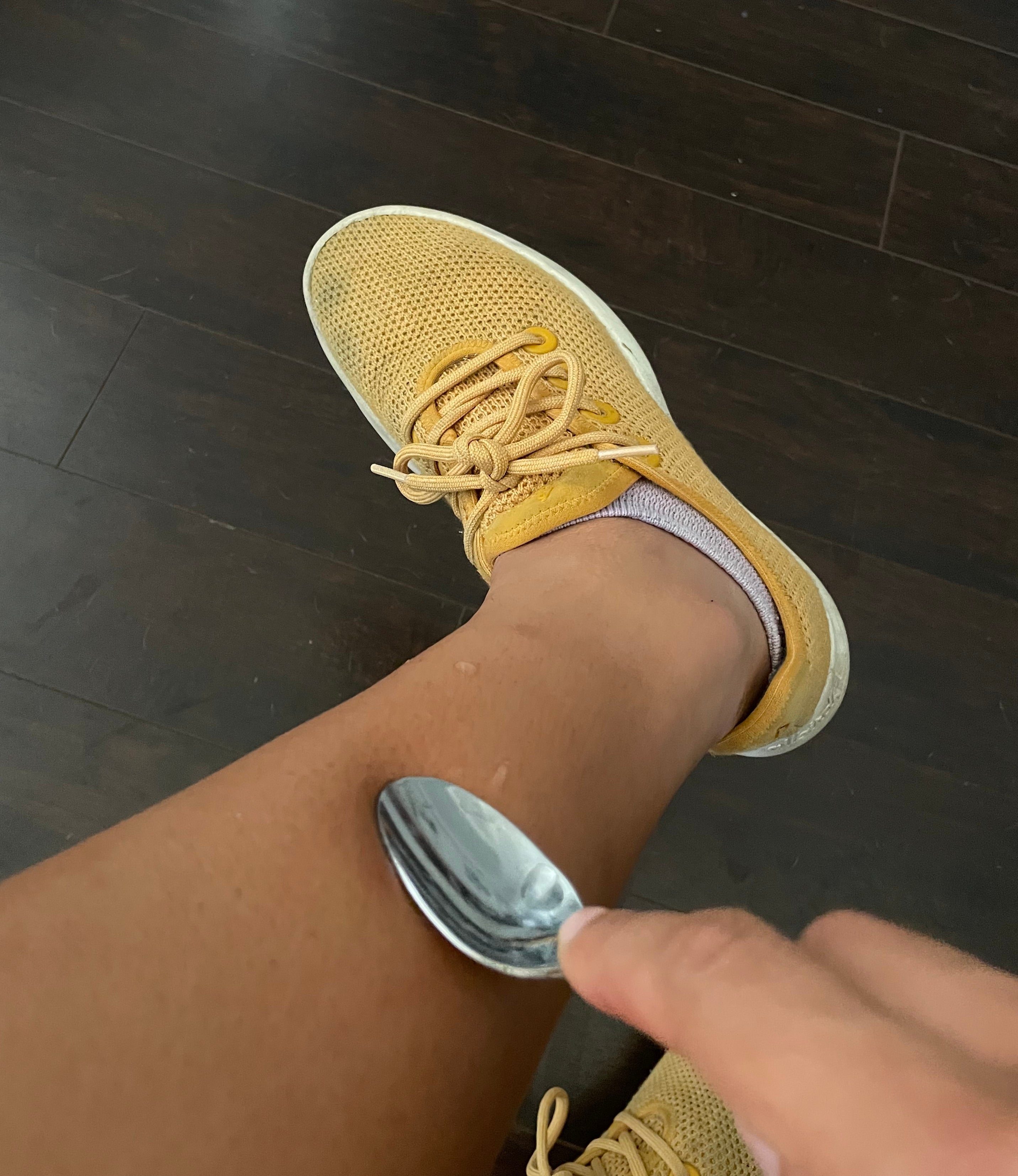 A person presses a spoon to a red, irritated spot on the skin on the leg to soothe it