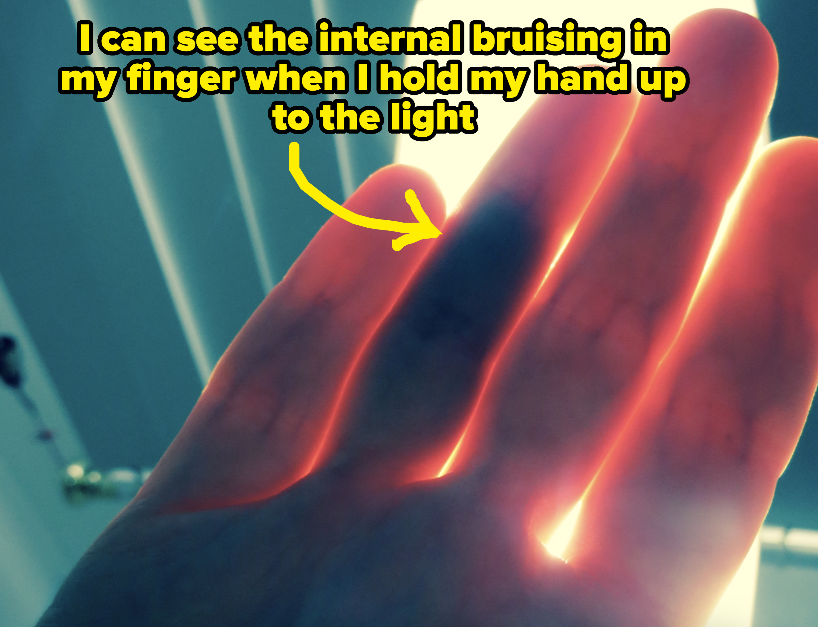 Hand held up against light, fingertips illuminated with an ethereal glow, showcasing the translucent nature of the skin