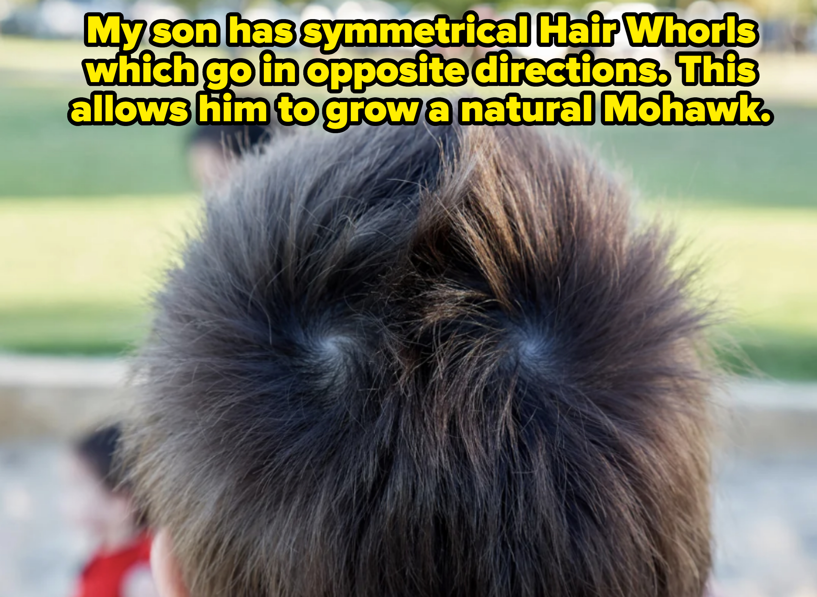 Close-up of a child's head with two prominent cowlicks on the scalp at an outdoor park