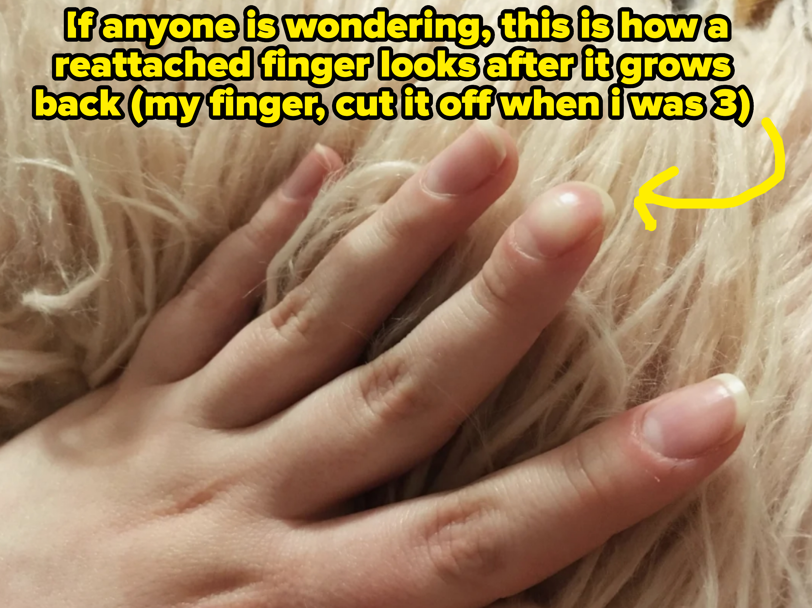 A hand rests gently on a fluffy surface, fingers slightly spread apart
