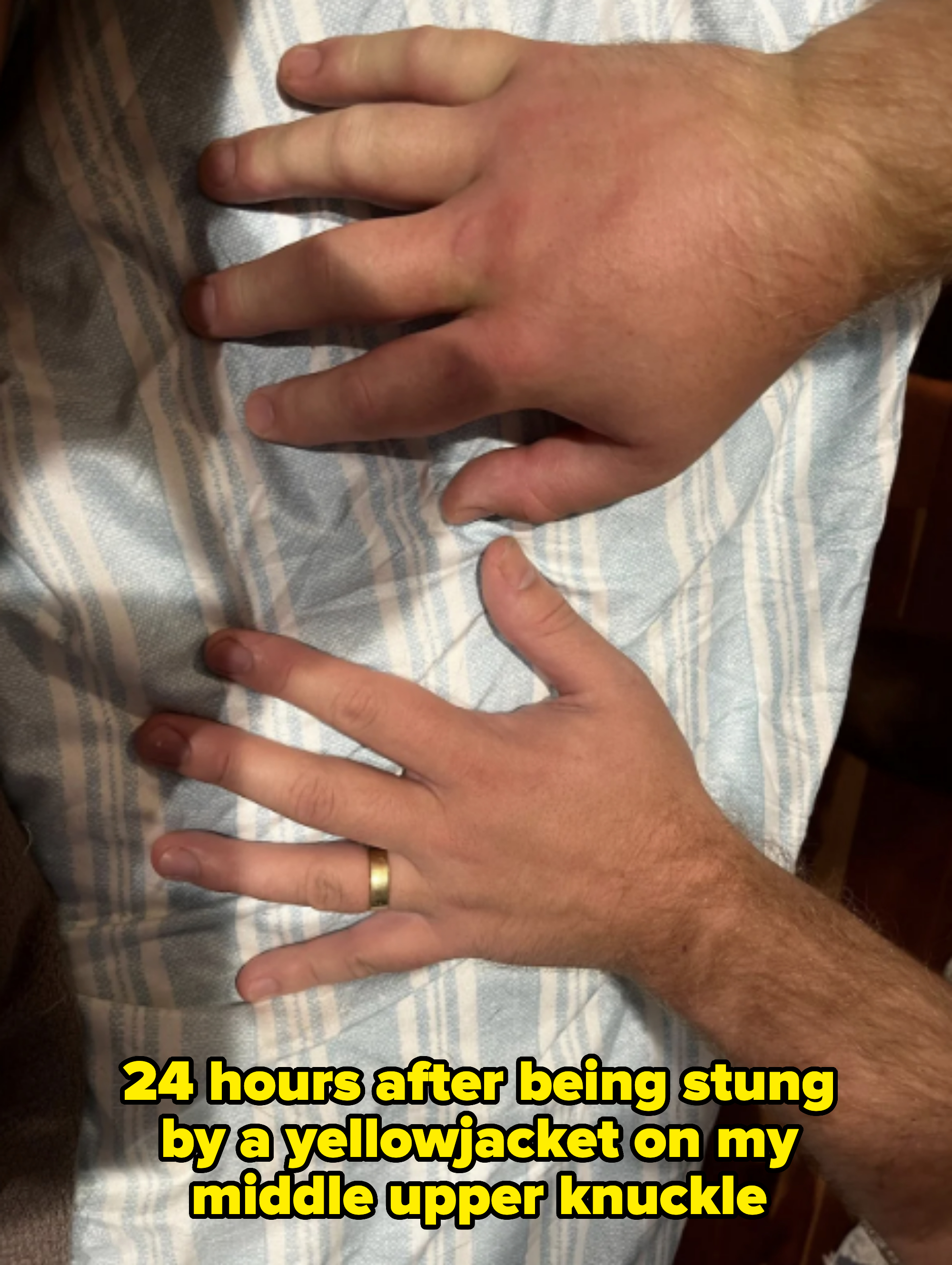 Two hands resting on a striped fabric. The left hand wears a gold wedding ring; the right hand is placed beside it