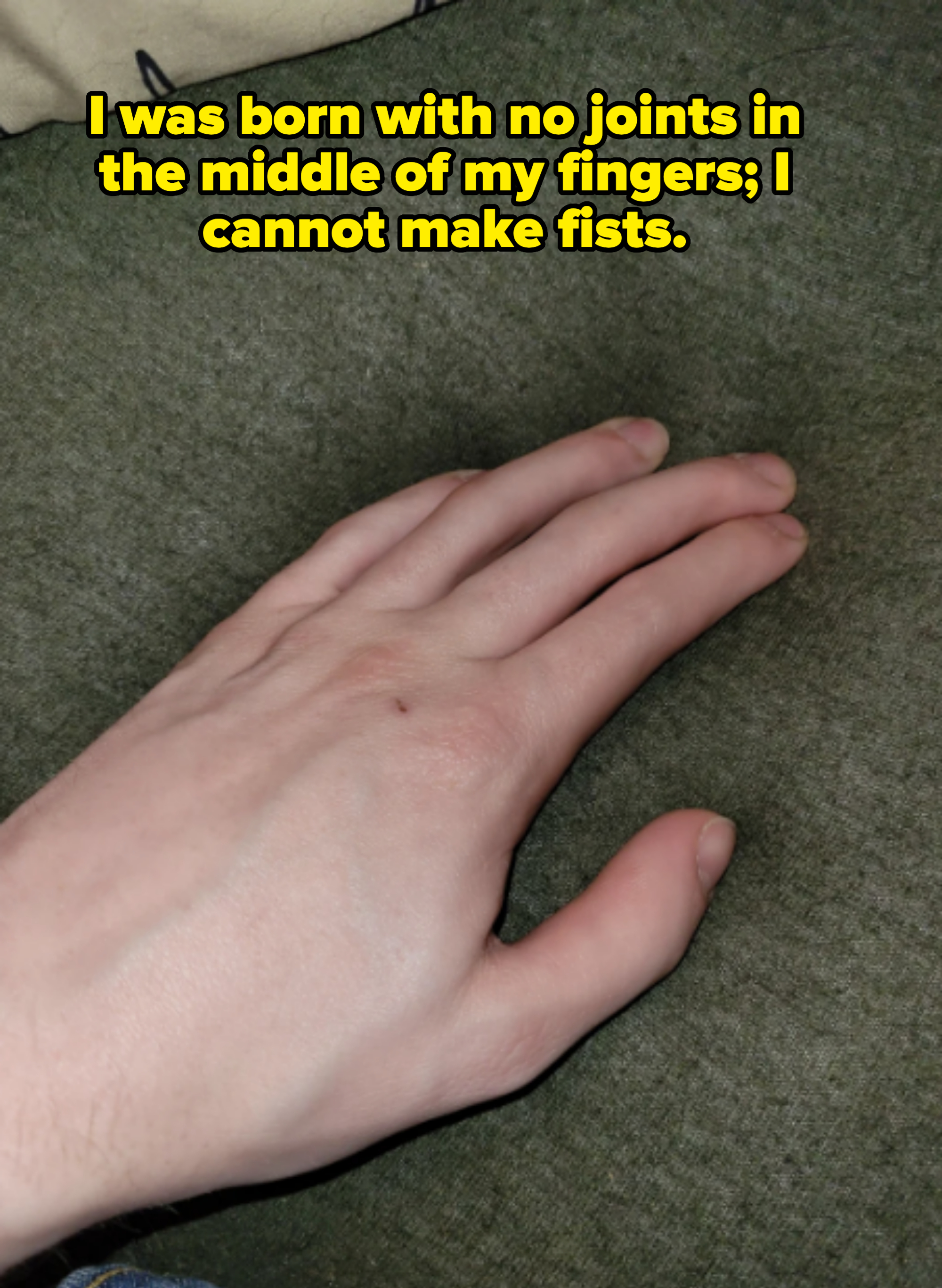 A close-up of a person's hand resting on a textured surface. The hand is positioned palm down with fingers slightly apart