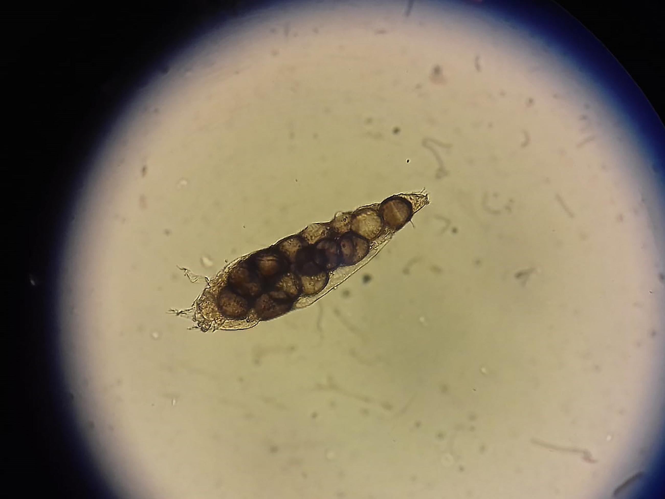Microscopic view of a rotifer, a tiny, multicellular organism, with its internal structures visible. Image captures details under magnification