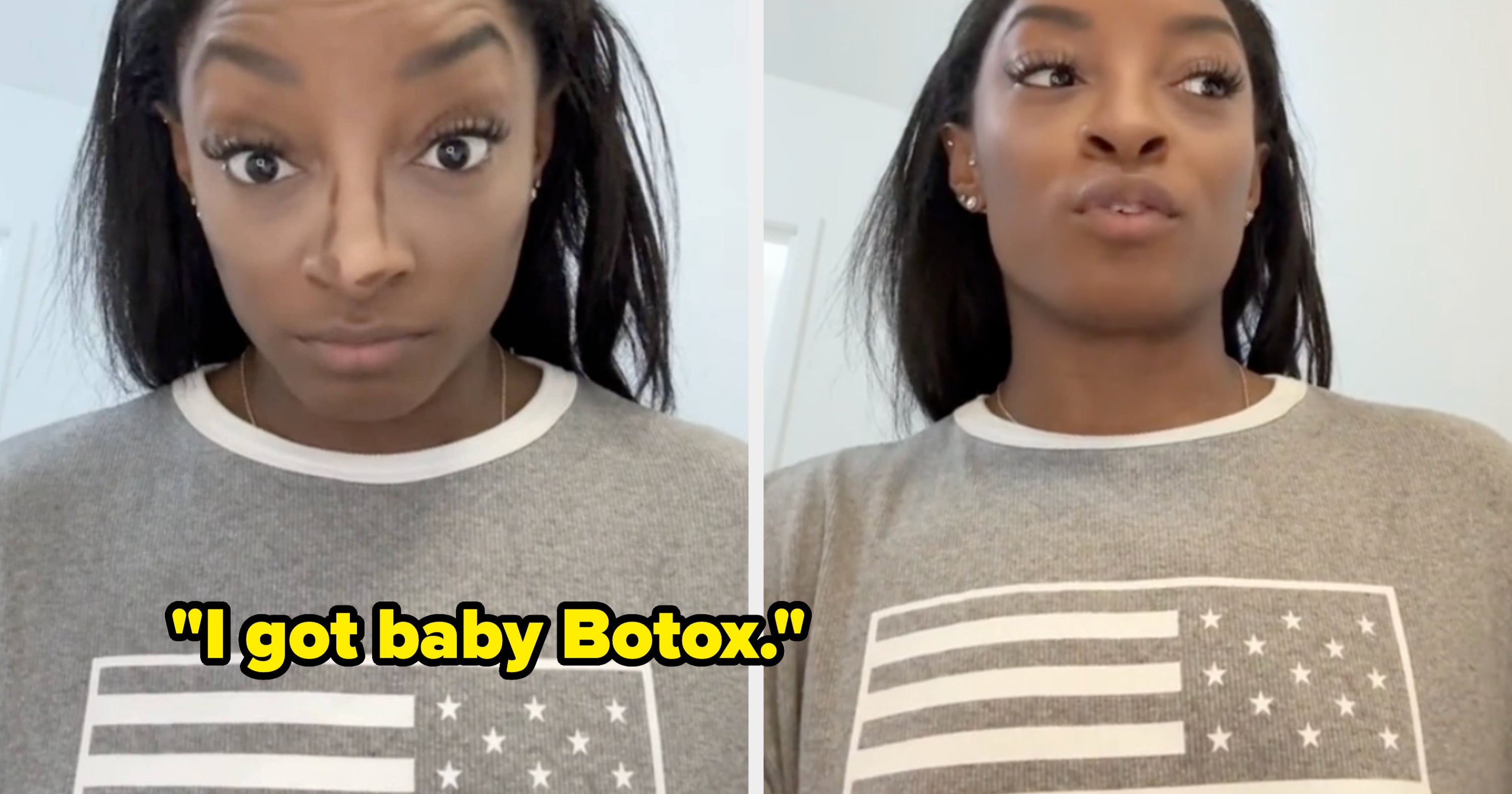 Simone Biles Discussed Her Experience With Botox