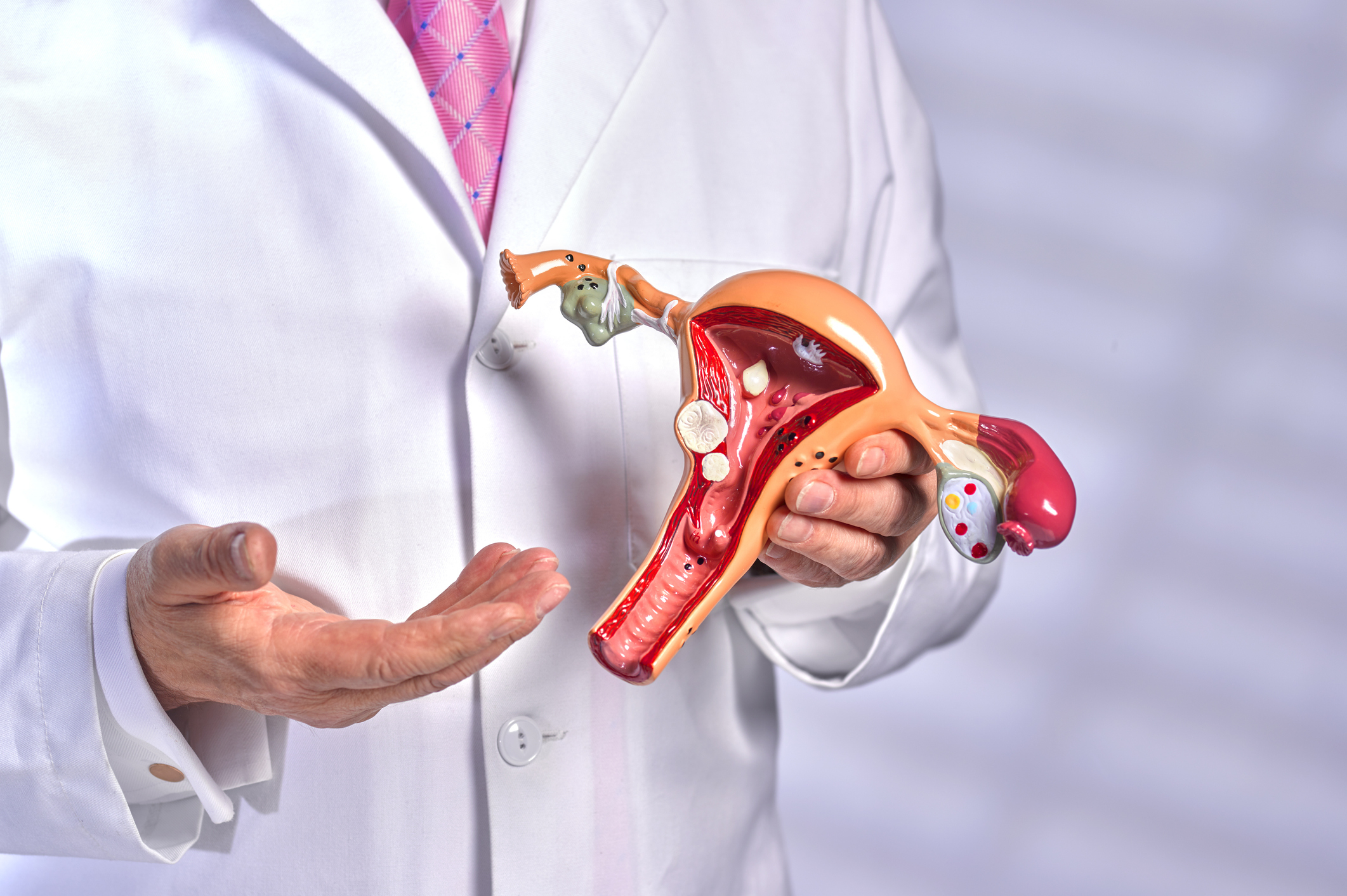 A doctor in a white coat and pink tie holds a model of the female reproductive system, focusing on the uterus, fallopian tubes, and ovaries