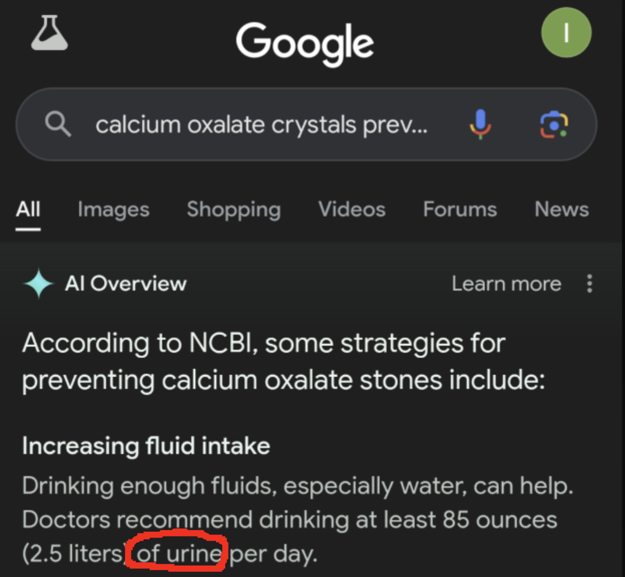 Strategies to prevent calcium oxalate stones include increasing fluid intake to produce at least 85 ounces (2.5 liters) of urine per day, according to NCBI