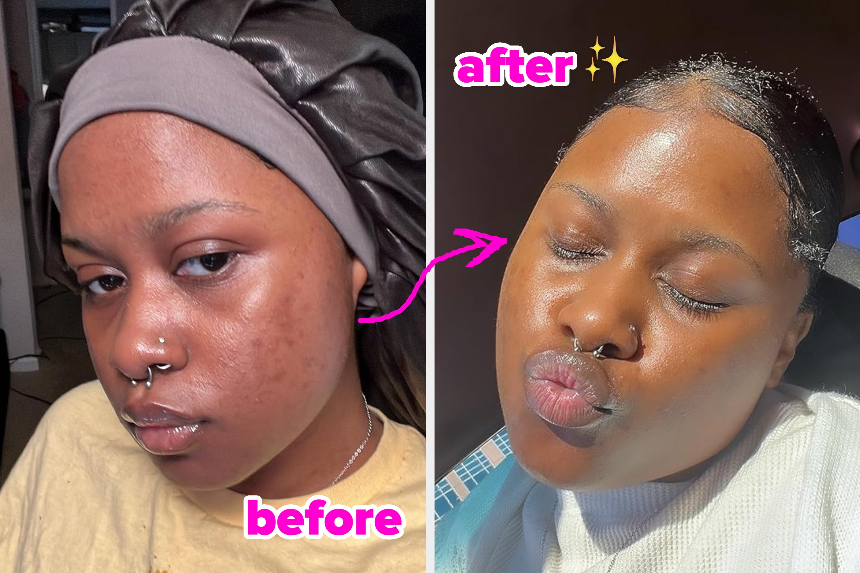 28 Korean Beauty Products That Are Worth The Hype (With Before And Afters To Prove It)