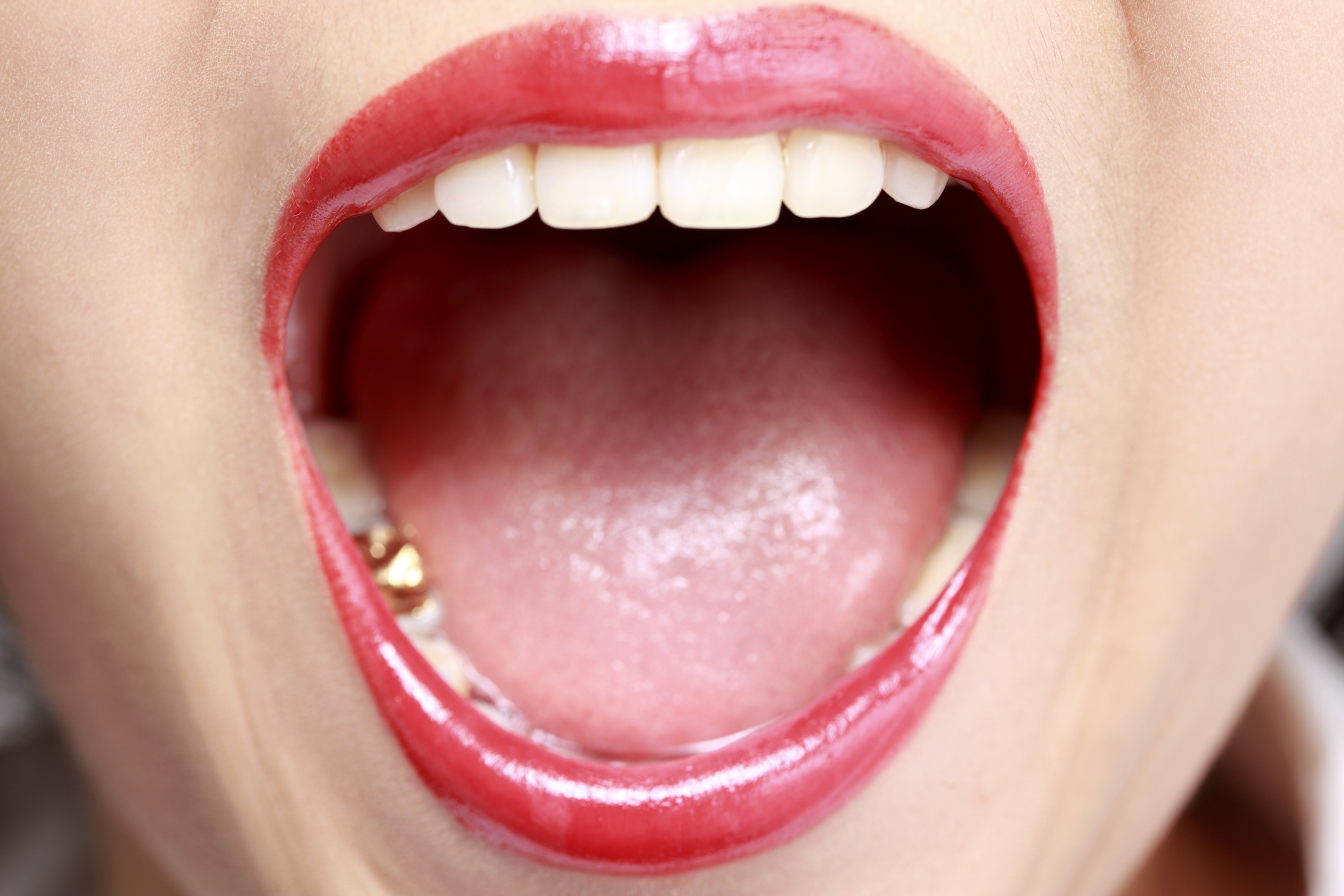 A close-up of an open mouth with red lipstick, showing white teeth and the tongue