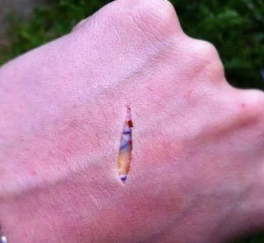 A close-up of a hand with a long, thin cut in the skin, displaying the wound clearly