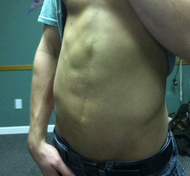A person's bare torso is visible, showing abdominal muscles. Their face is not visible. They are wearing jeans and holding their shirt up slightly