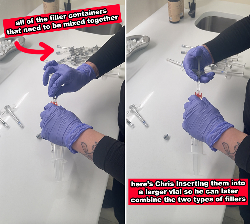 Two images show Chris wearing purple gloves, mixing two types of filler into a larger vial
