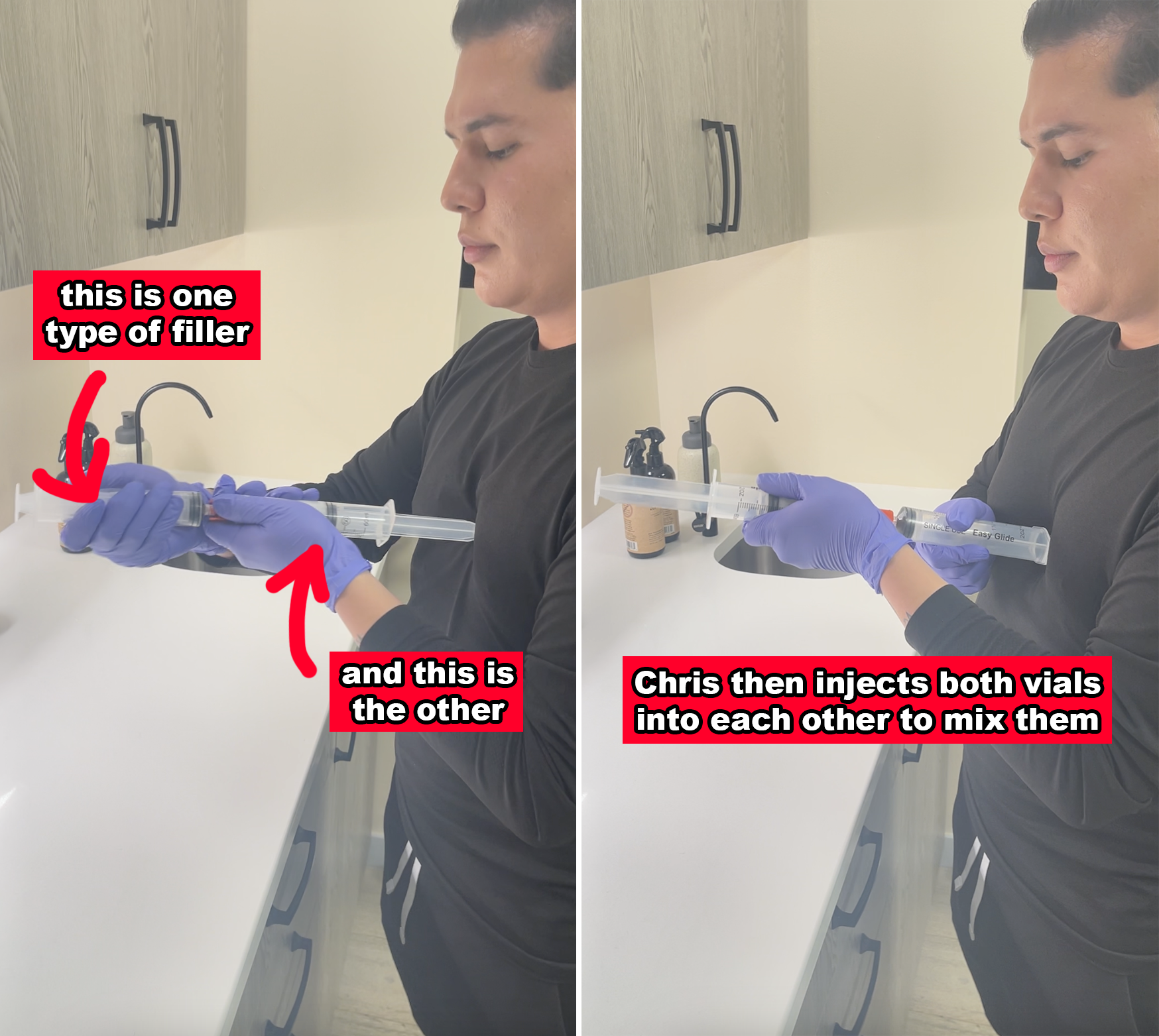 Chris mixing the two types of filler in different syringes