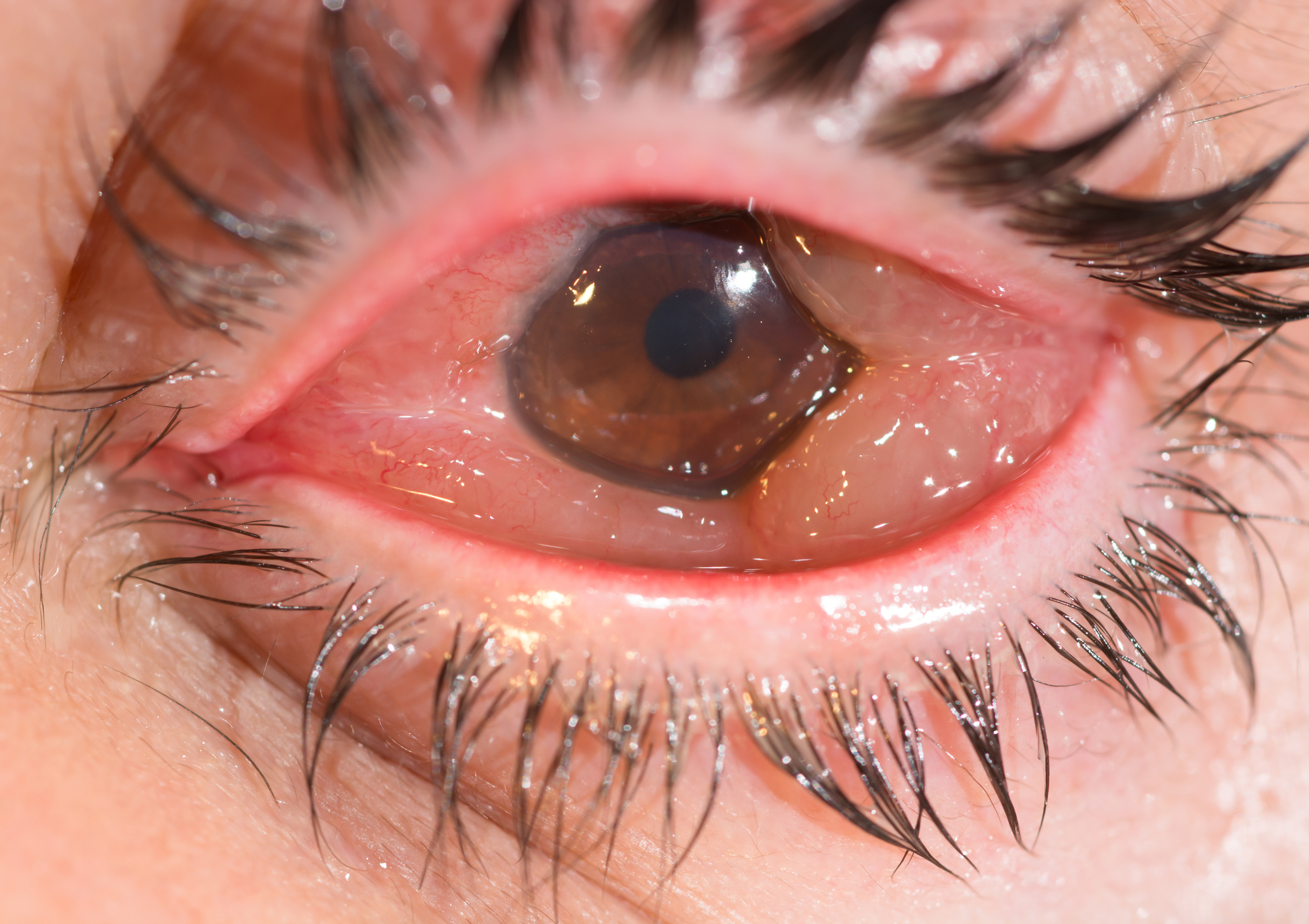 Extreme close-up of an eye with long eyelashes and watery details