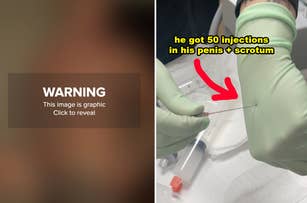 Warning graphic image: A tattooed person in gloves prepares a needle; text indicates 50 injections in the penis and scrotum