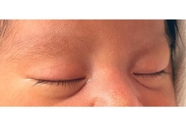 赤ちゃんの目の写真が2つ並んでおり、どちらの目も「cute」という黄色いシールで覆われています。