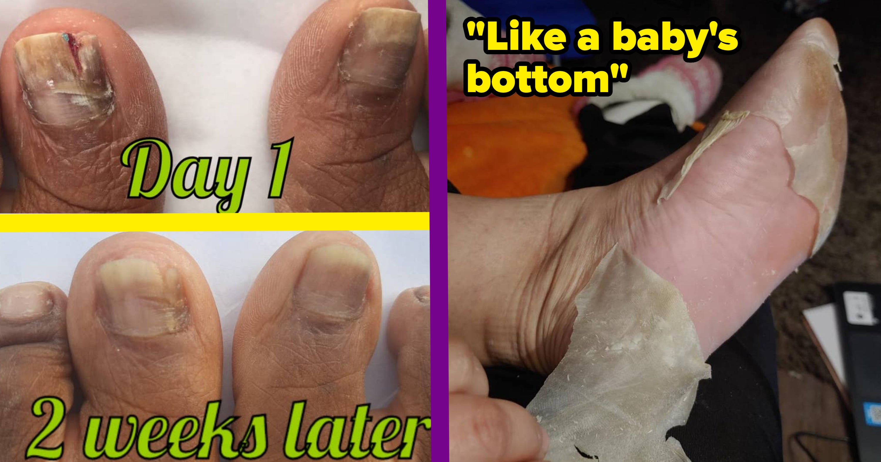 30 Products To Transform Your Feet This Fall