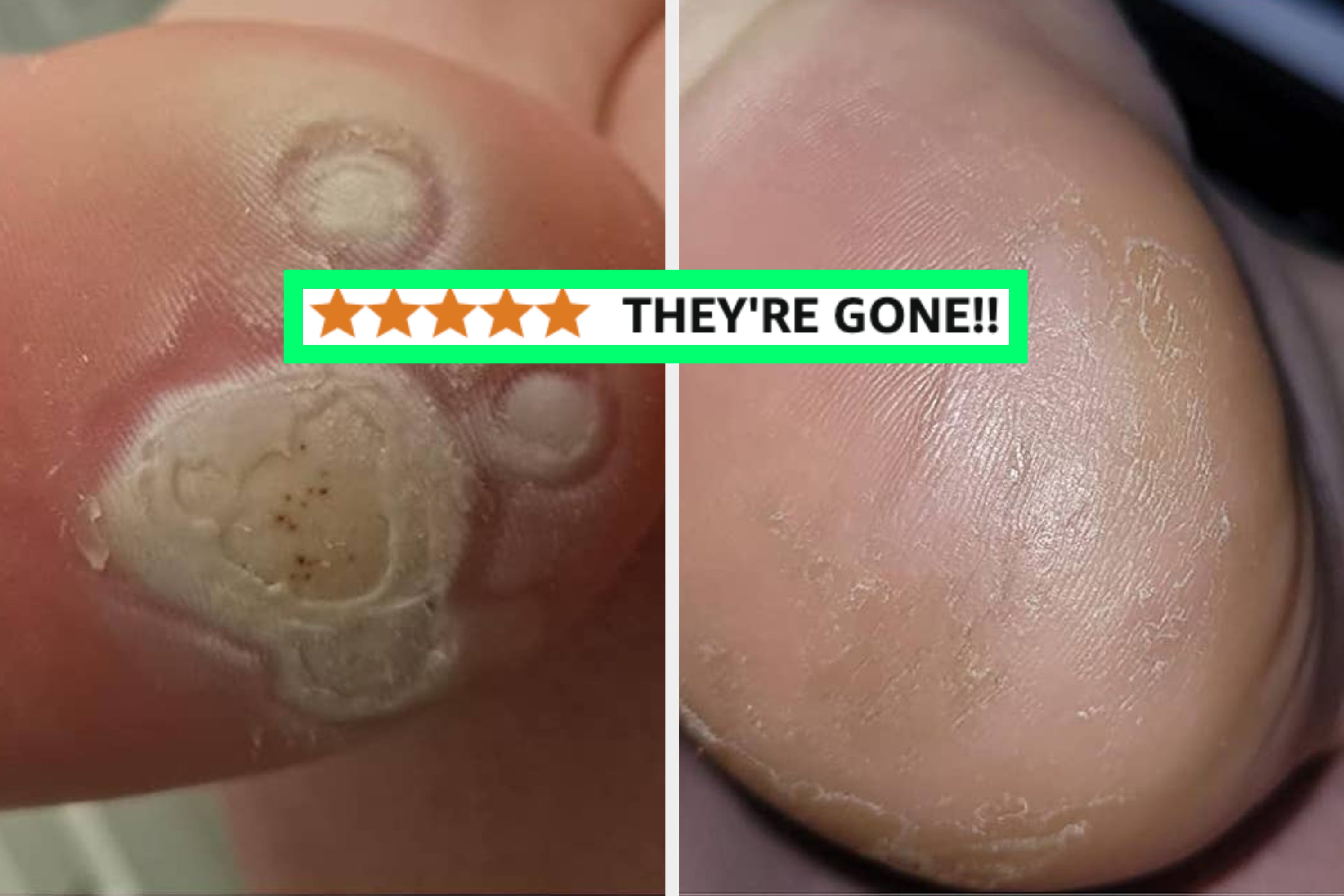 24 Products With Before And After Pics That Might Keep You Up At Night