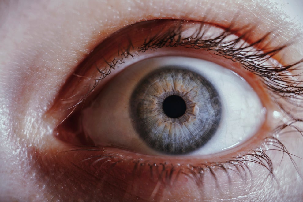 39 Body Abnormalities People Revealed They Have