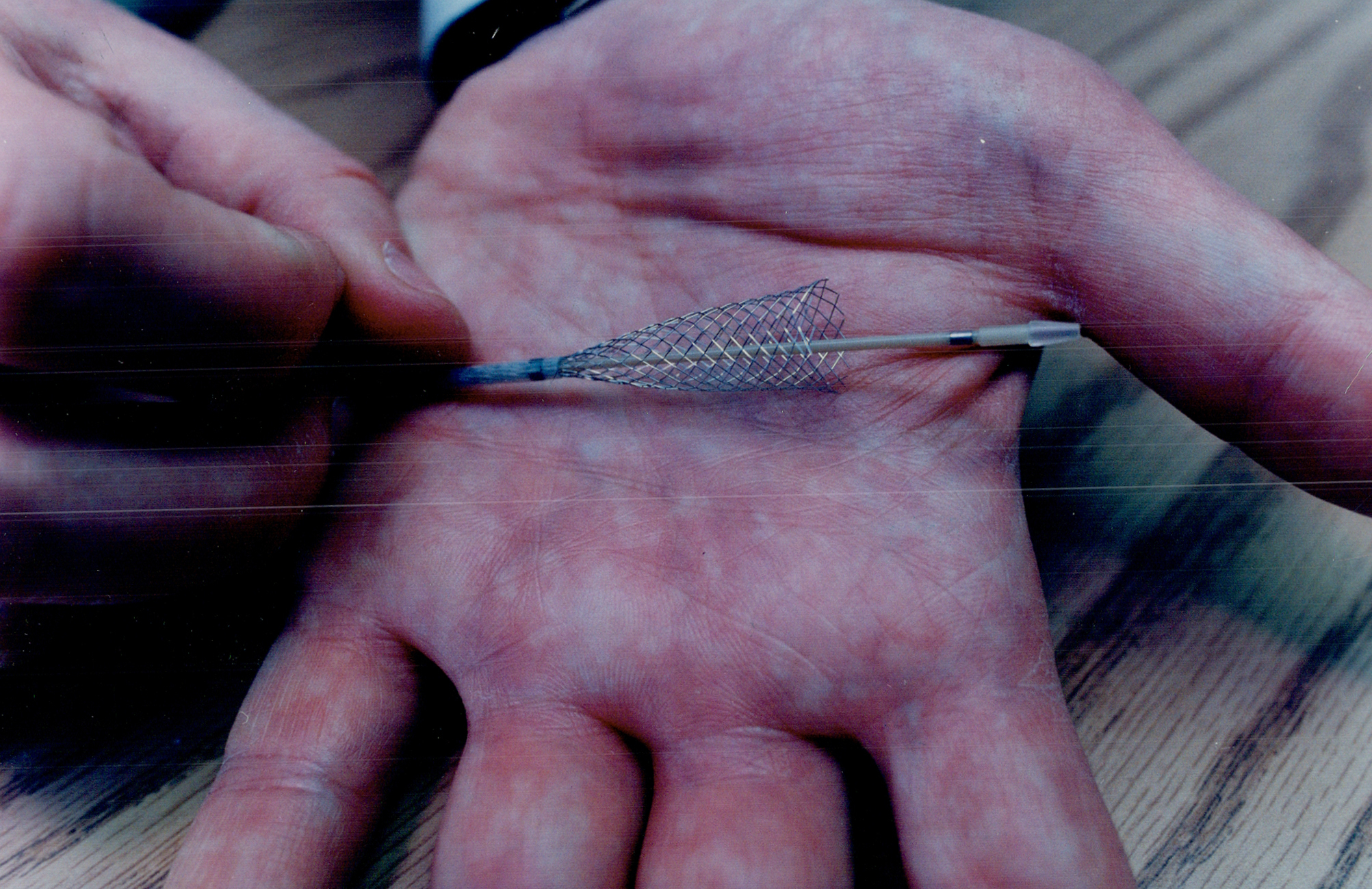 A hand holding a medical device known as a stent, which is commonly used to keep arteries open in the body