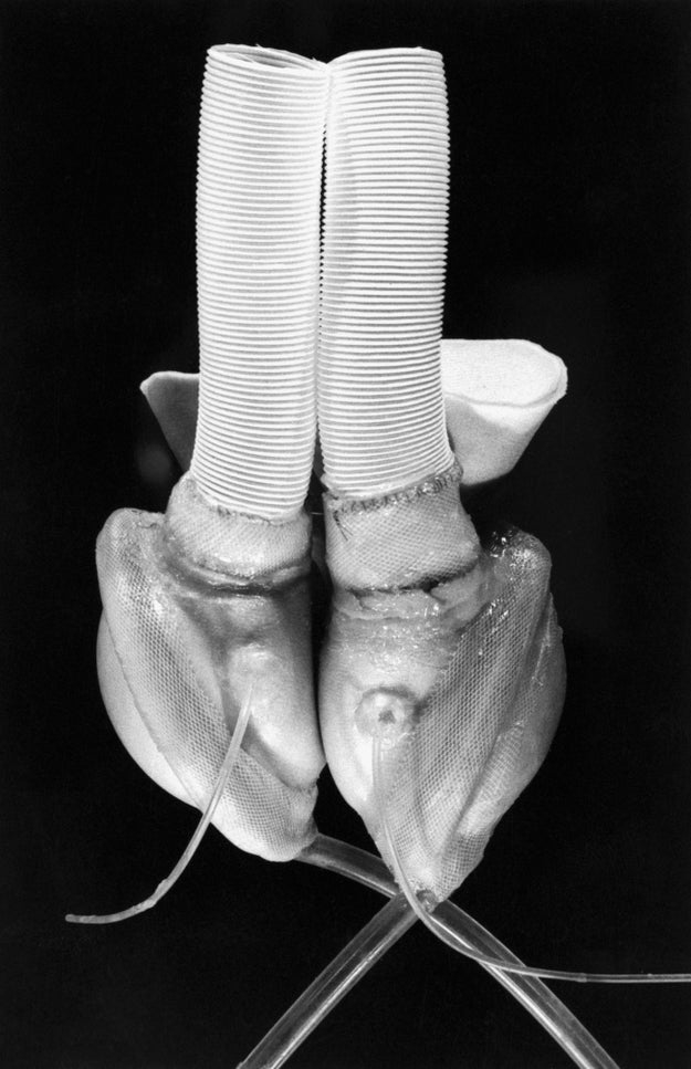 Close up black and white image of an artificial heart with two ventricals