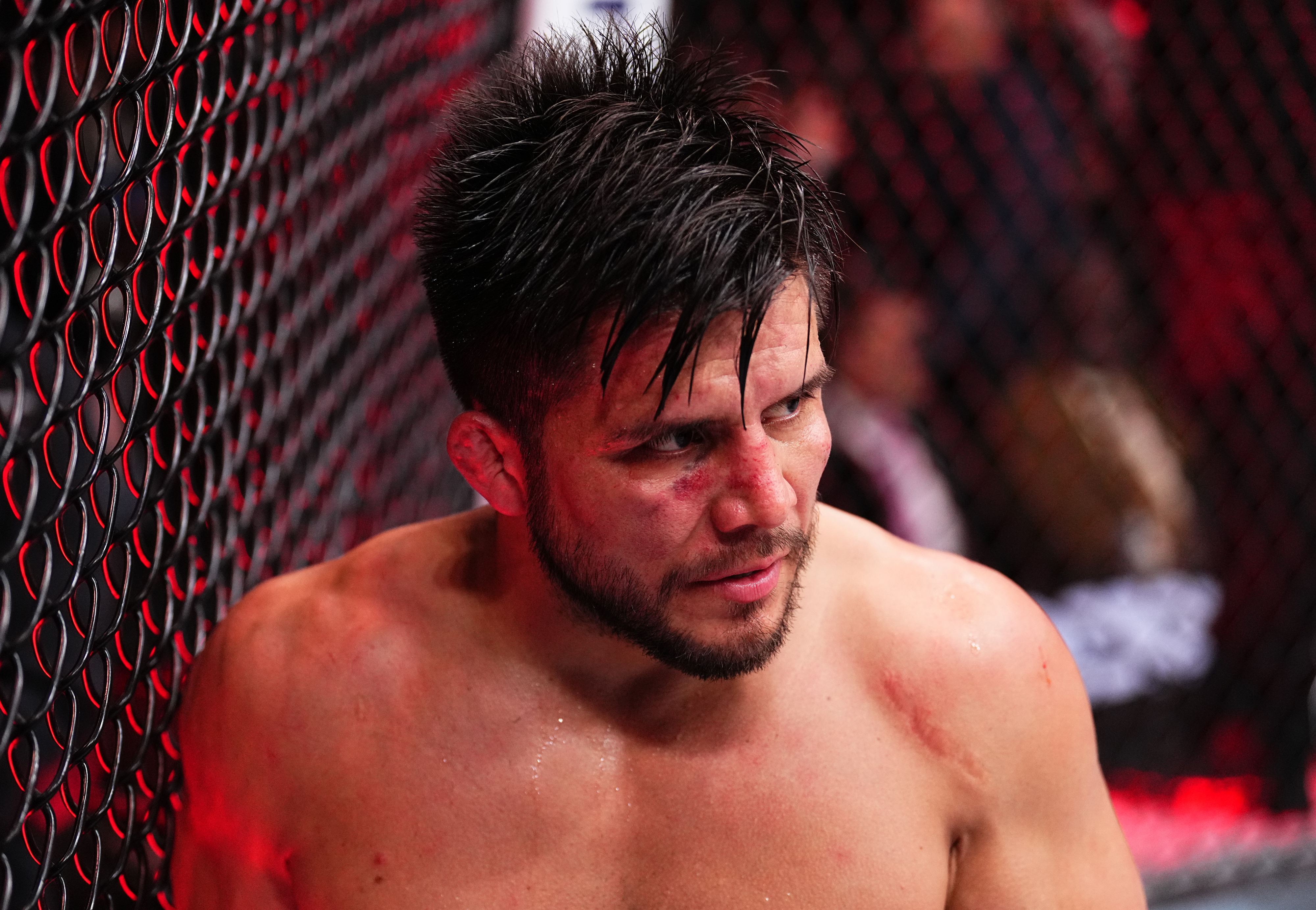Henry Cejudo, shirtless and leaning against a cage, with a determined expression and signs of a physical altercation on his face and body