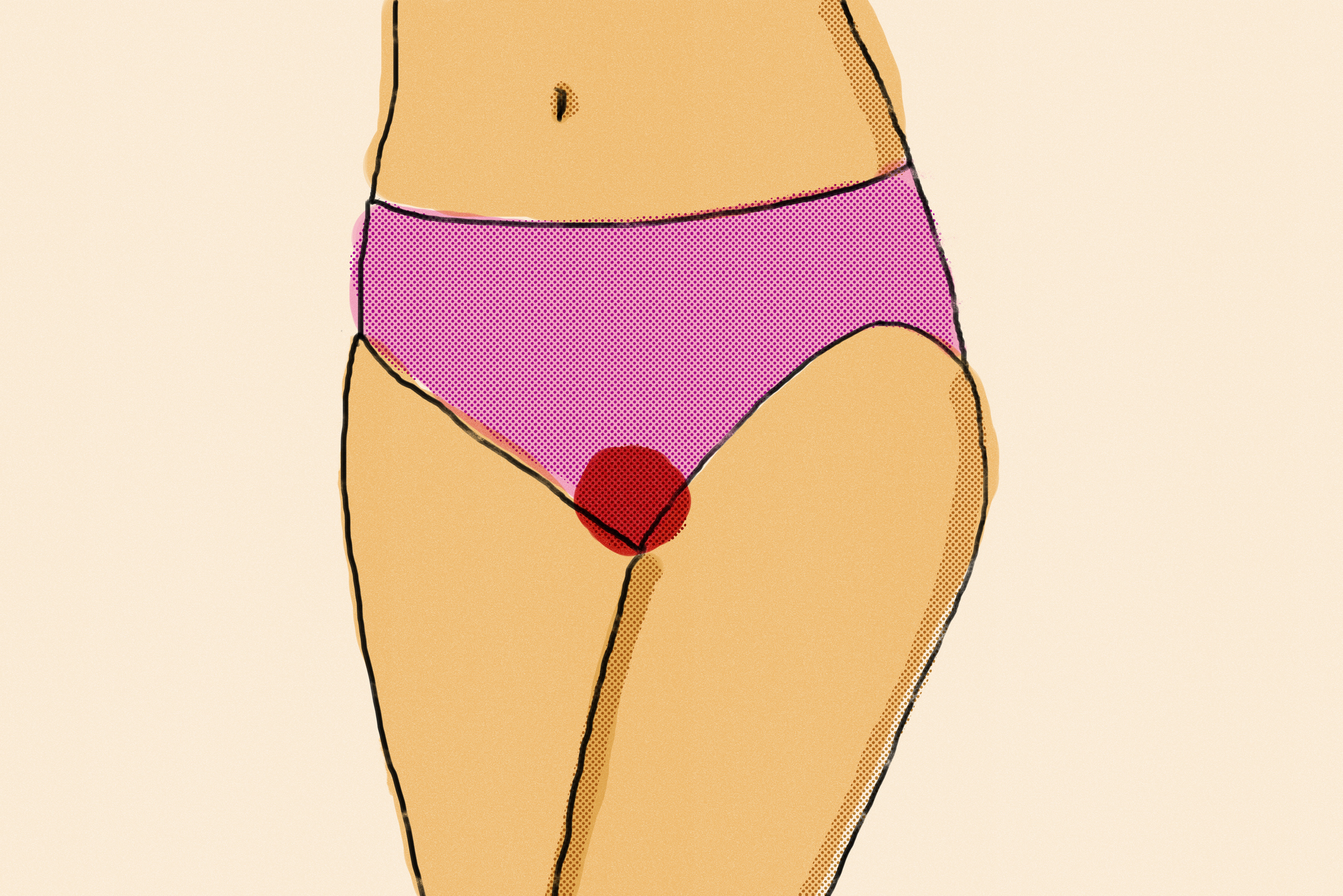 Illustration of a woman's lower torso wearing underwear with a red stain, suggesting menstrual bleeding or a period