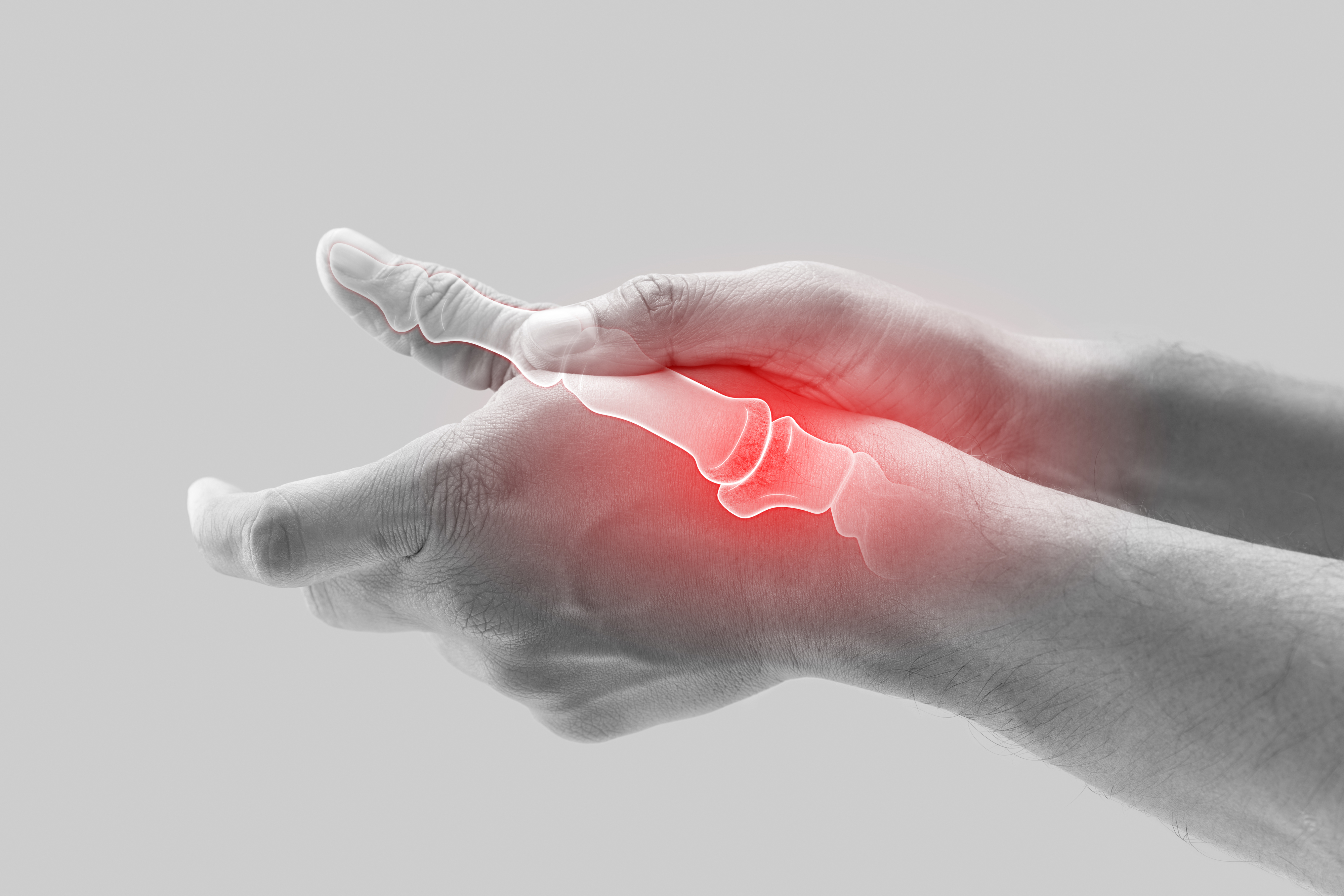 A pair of hands is shown with an overlay highlighting pain and inflammation in the thumb joints