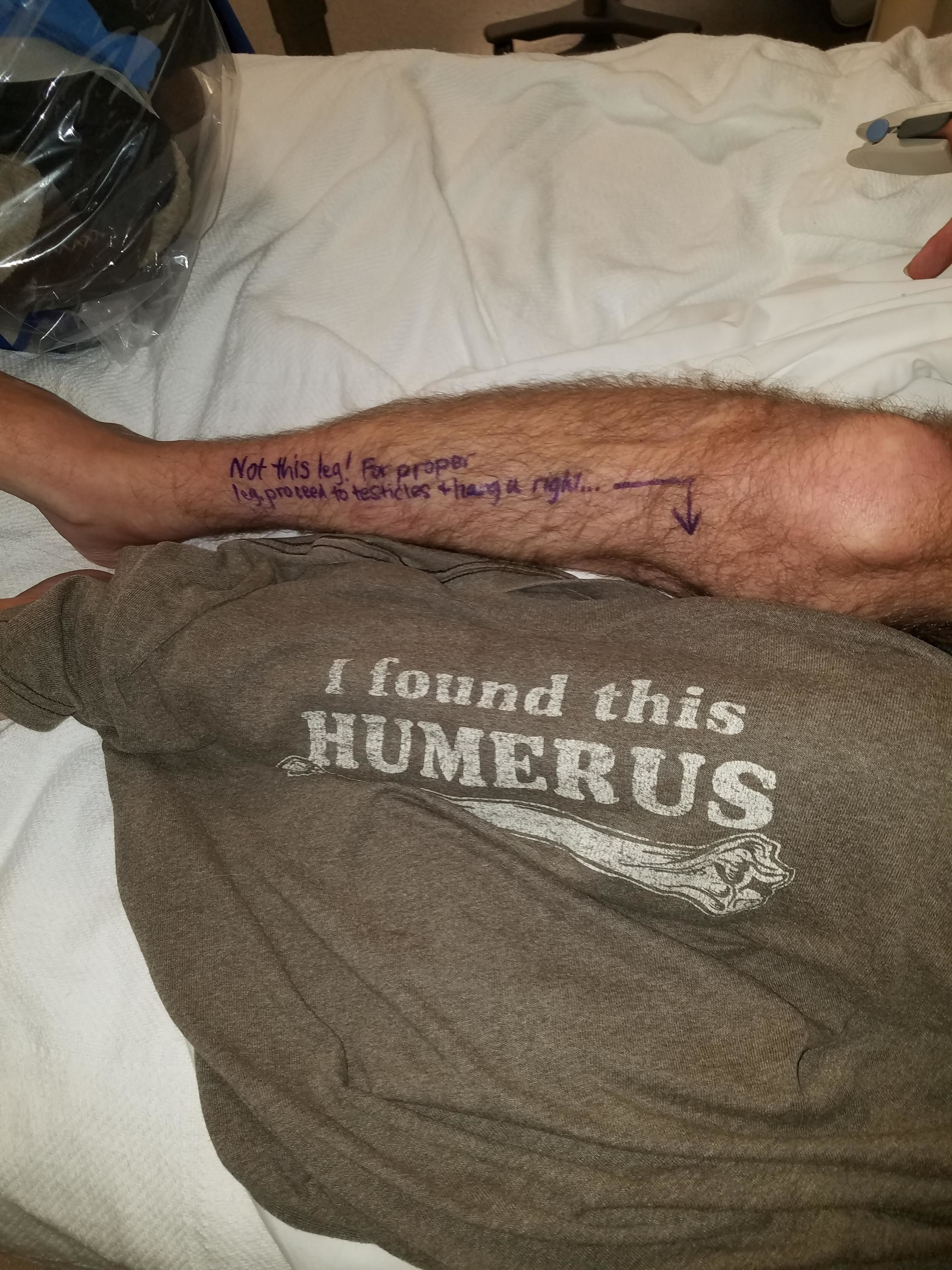 A person's leg with humorous marker scribbles, alongside a T-shirt that reads "I found this humerus." The leg's scribbles instruct proper surgical location
