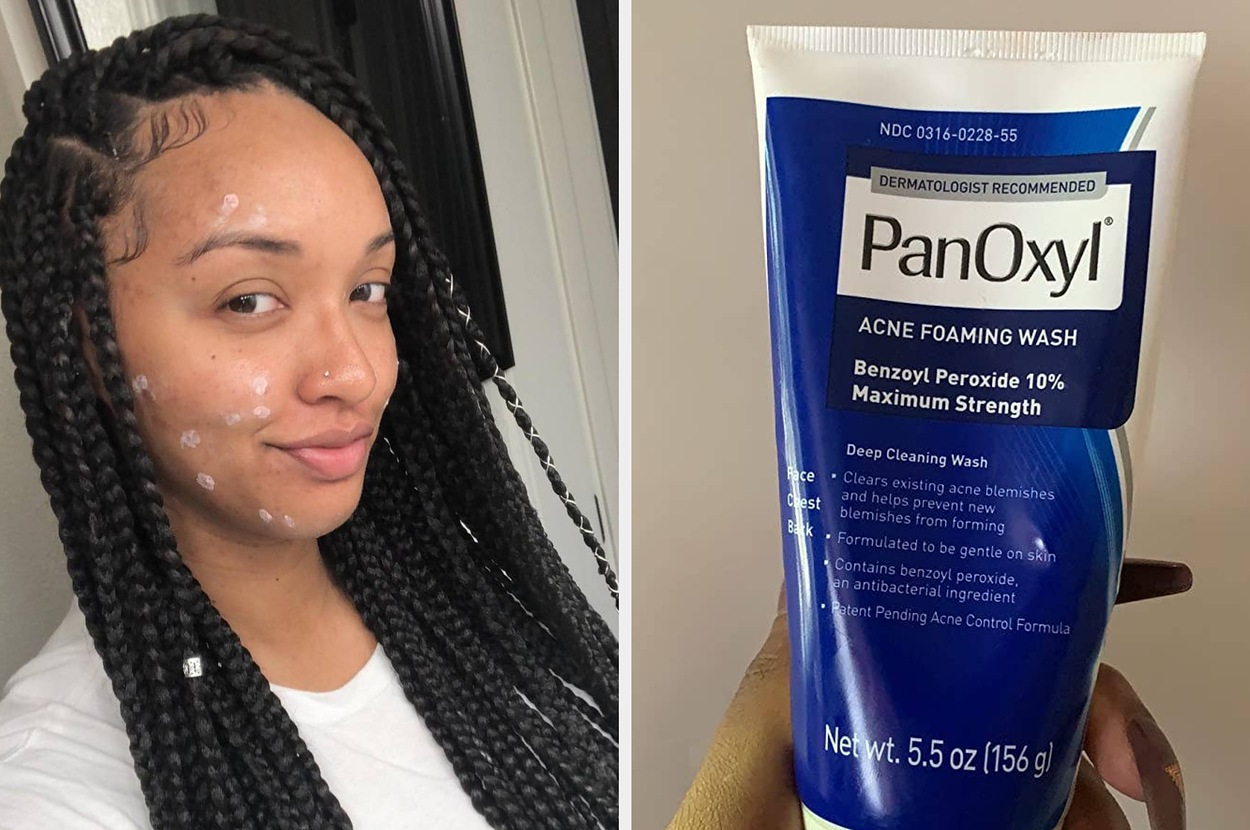 27 Best Products For Hormonal Acne In 2025