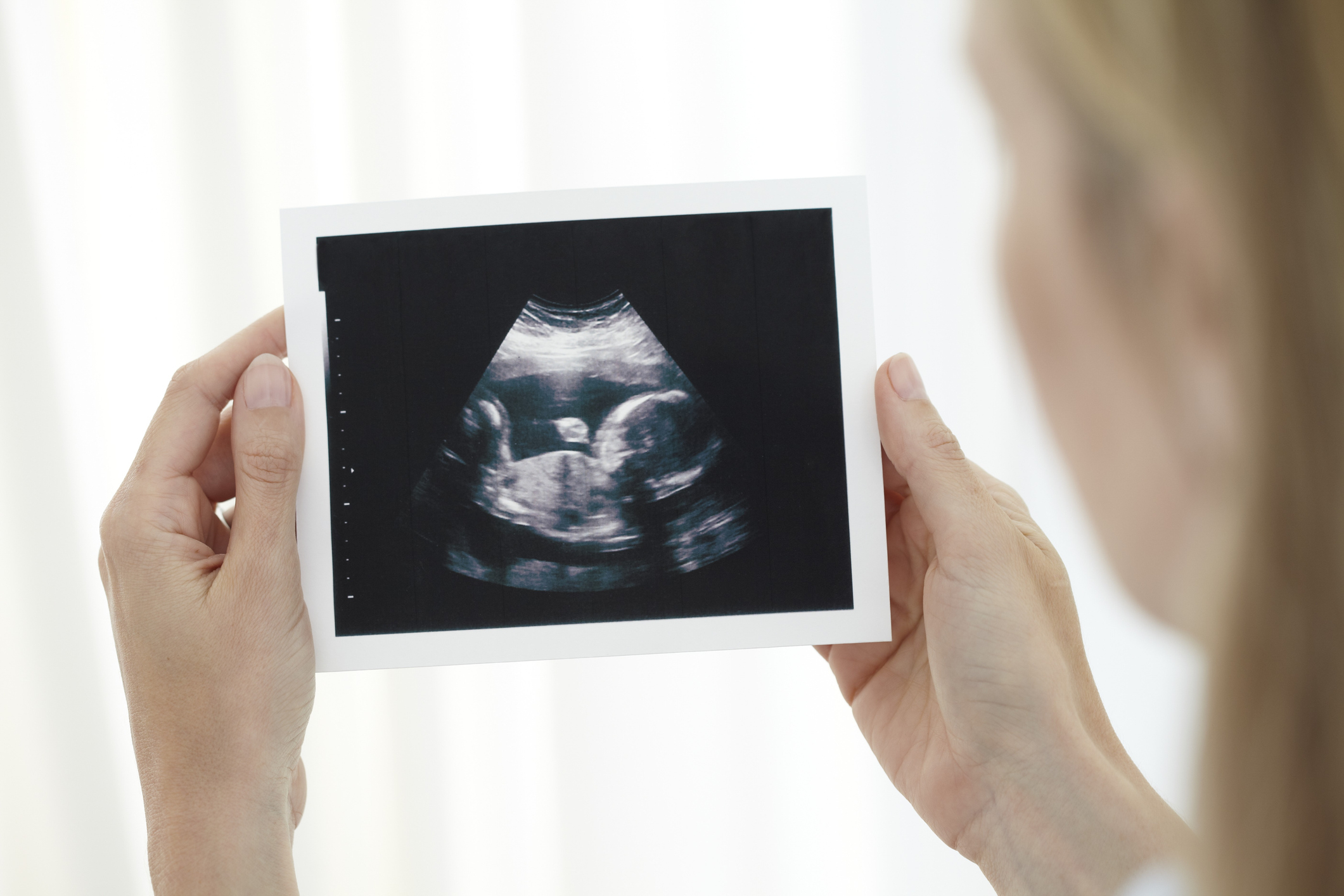 Person holding an ultrasound image of a fetus, representing pregnancy