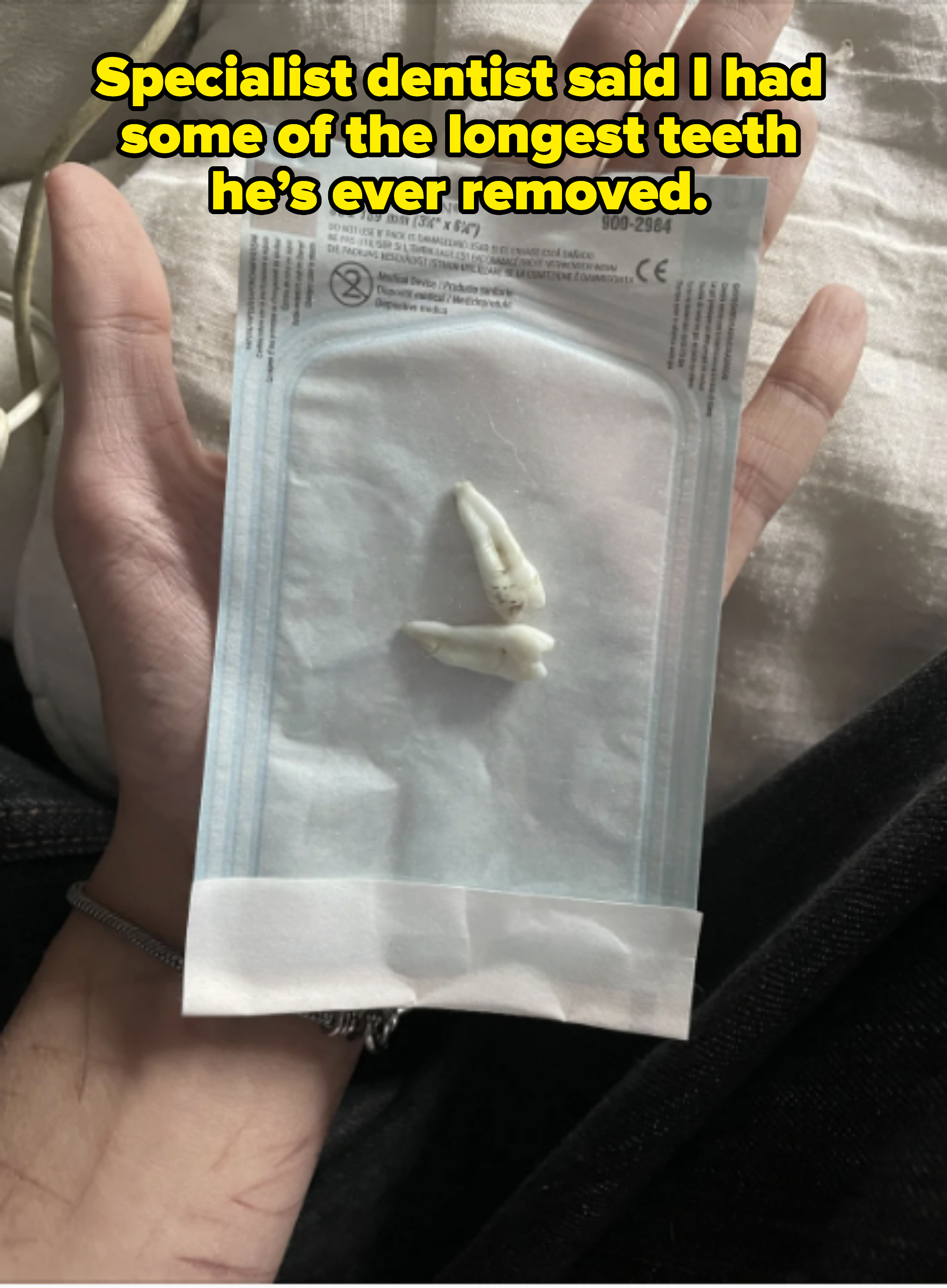 A person holding a sealed packet with two extracted teeth inside. No text is included in the image