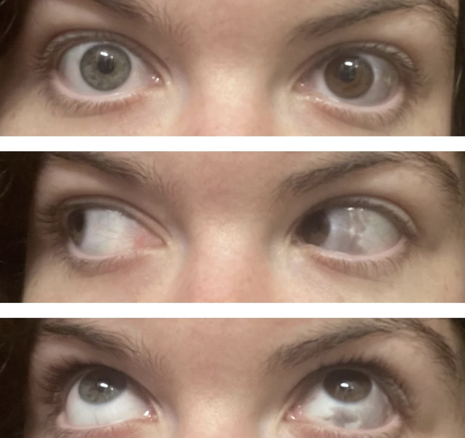 The image shows a close-up of a person's eyes in three rows. The top row looks straight, the middle row looks left, and the bottom row looks up