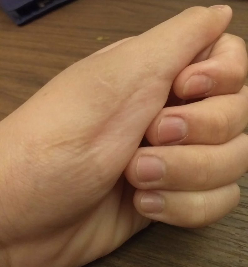 A close-up image of a person's hand with fingers interlocked, showing a relaxed and natural pose on a wooden surface