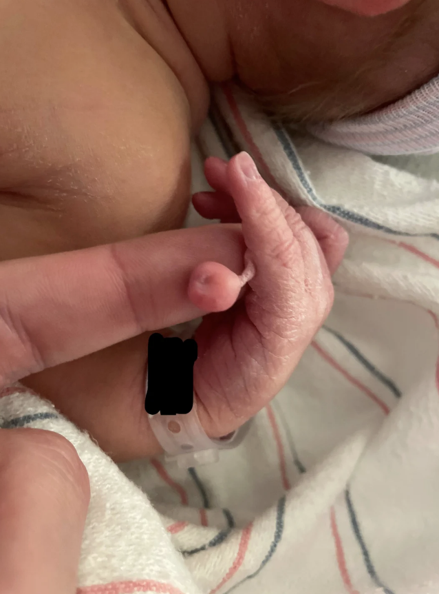 A newborn holding an adult's finger while swaddled in a hospital blanket. The baby wears an ID band around its wrist