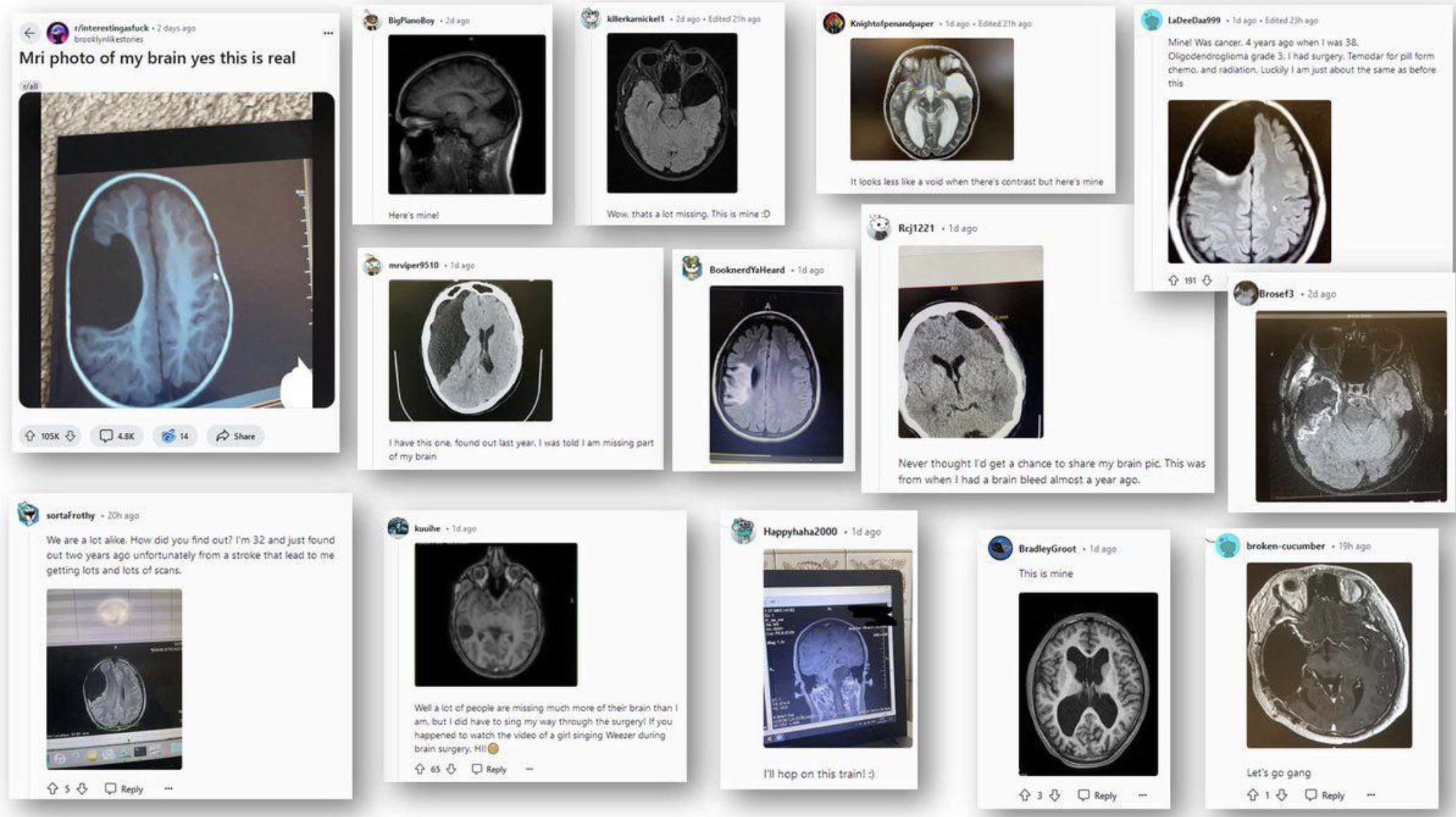 Collage of brain scan images with various Twitter users sharing personal thoughts and reactions about seeing their brain scans