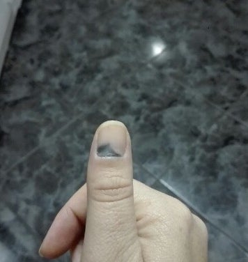 33 Unfiltered Pregnancy Photos Of What It's Really Like