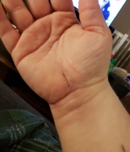 33 Unfiltered Pregnancy Photos Of What It's Really Like