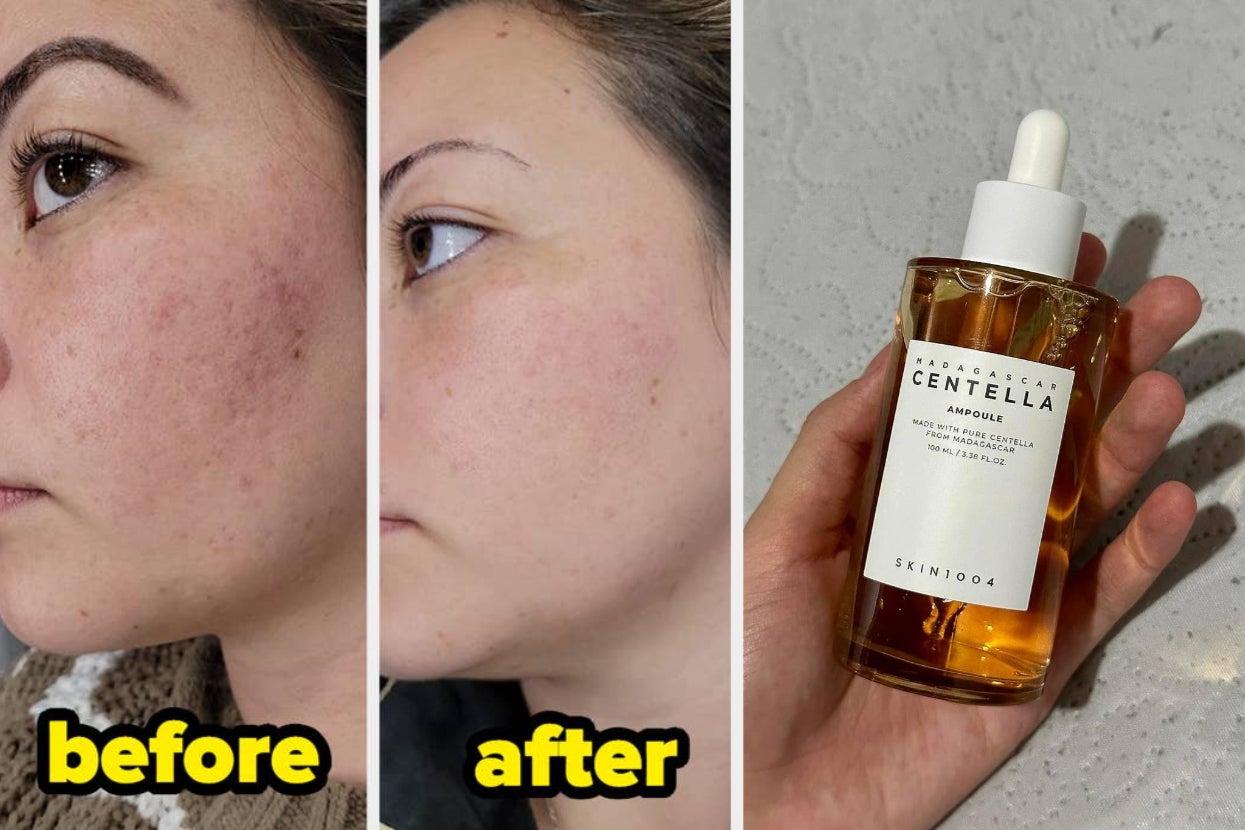 If You’re Sick Of Spending So Much Money On Skincare, These 31 Things Are Cheap *And* Deliver Serious Results