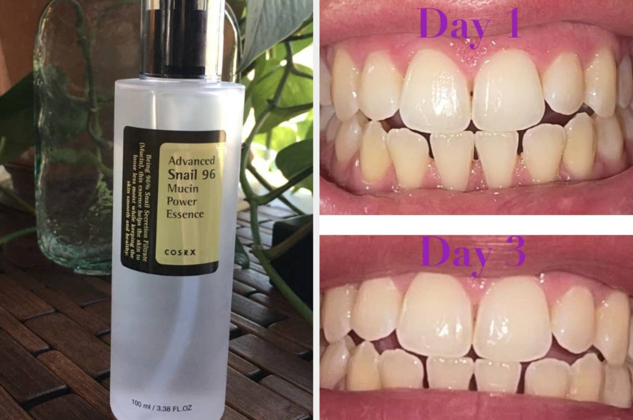 Before and after teeth whitening over 3 days, featuring a bottle of COSRX Advanced Snail 96 Mucin Power Essence