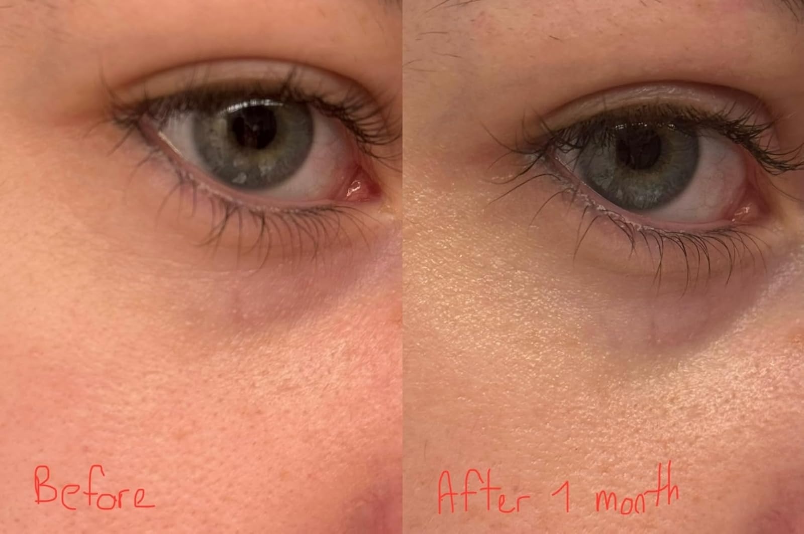 Reviewer before and after using eye cream