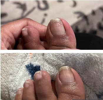 Reviewer's toed nail earlier and aft utilizing oil