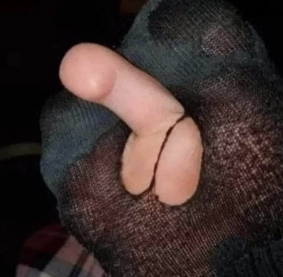A thumb pokes through a hole in a dark, worn-out sock, making it look like a finger puppet with simple features