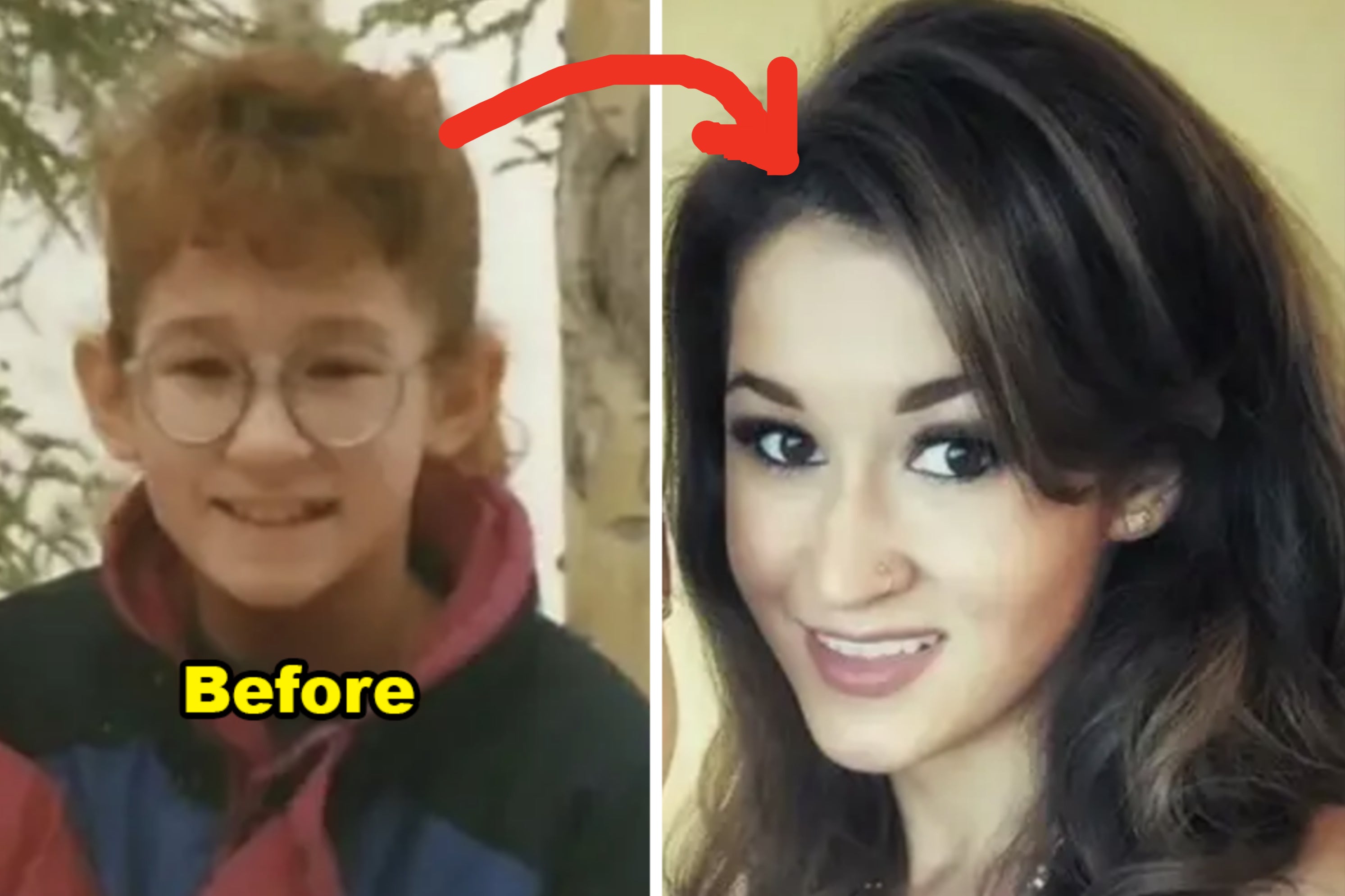 33 "Before-And-After" Puberty Glow-Up Transformations That Actually Made My Jaw Drop