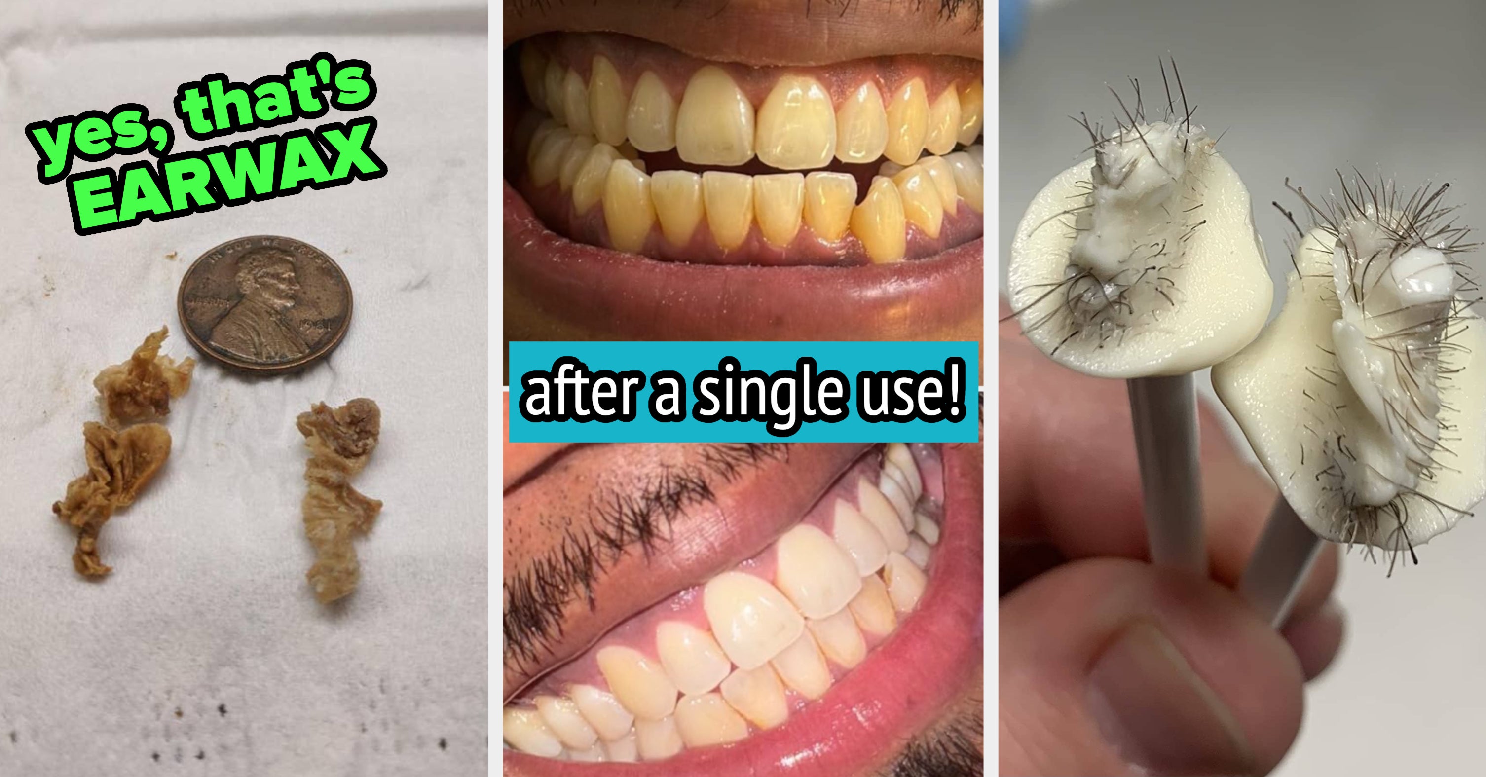 34 Things For The Maddening Body Issues That Plague You