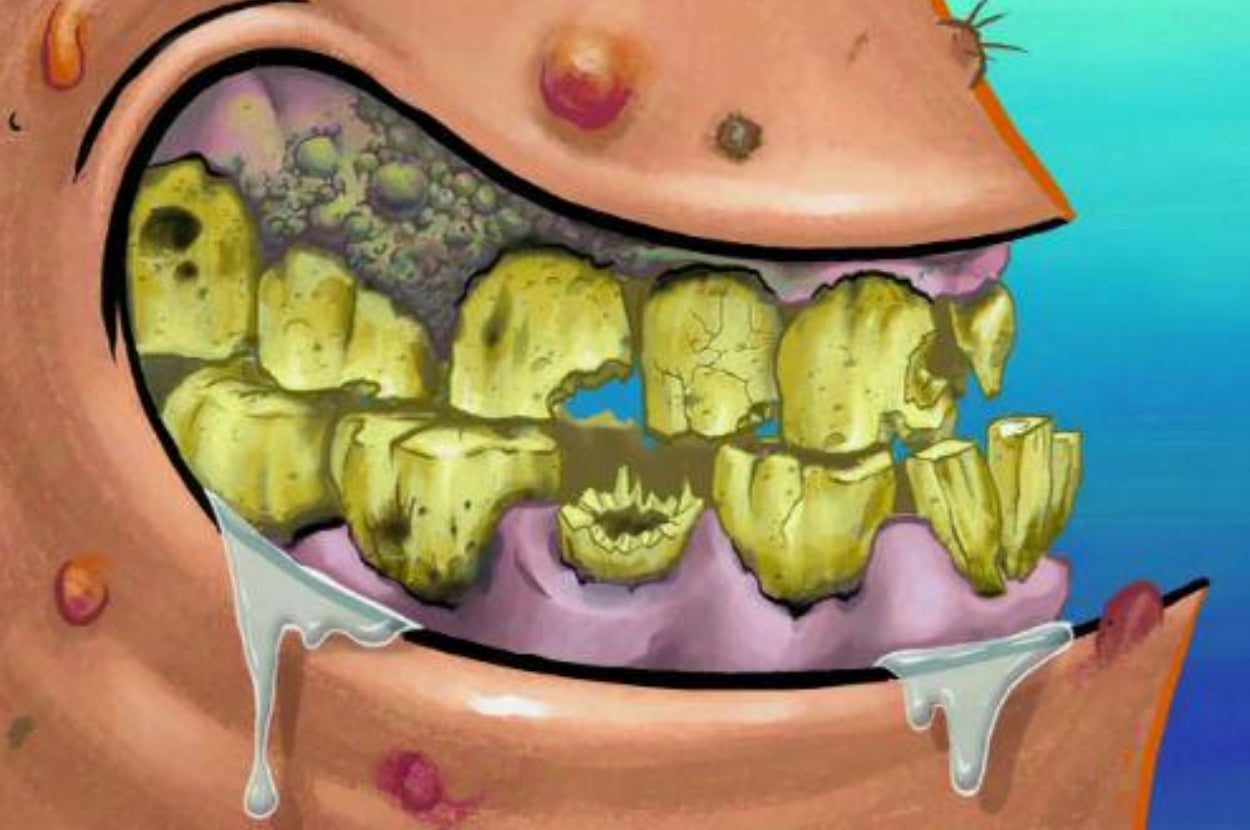 Cartoon character with decaying yellow teeth and drooling from the mouth