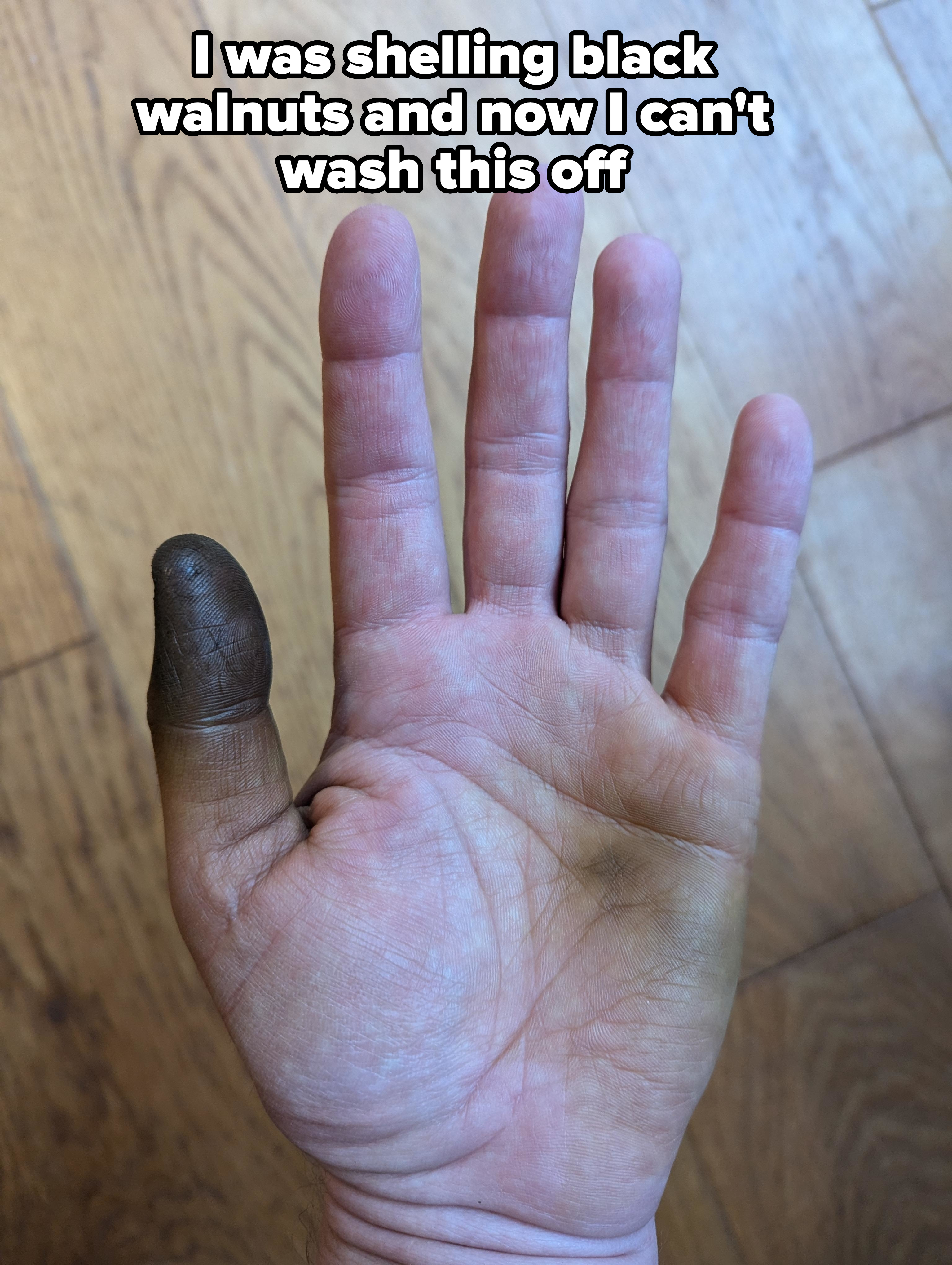 An open hand with a thumb stained dark, contrasting with the rest of the clean palm and fingers